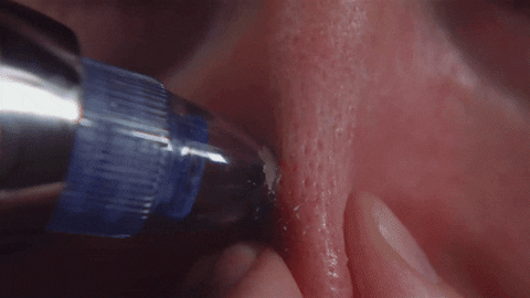 Blackheads Remover Vacuum